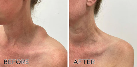 LipomaCure SCI Soothing Ointment - Image 3