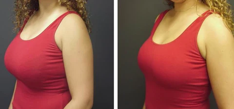 PlumpyUp Breast Lifting Organic Essence Serum - Image 3