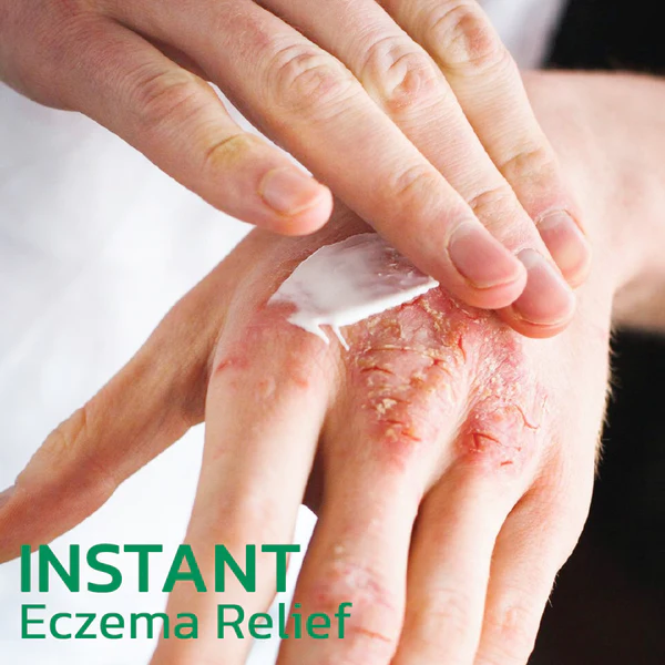 EczoTherapy Herbal Hydration Cream - Image 3