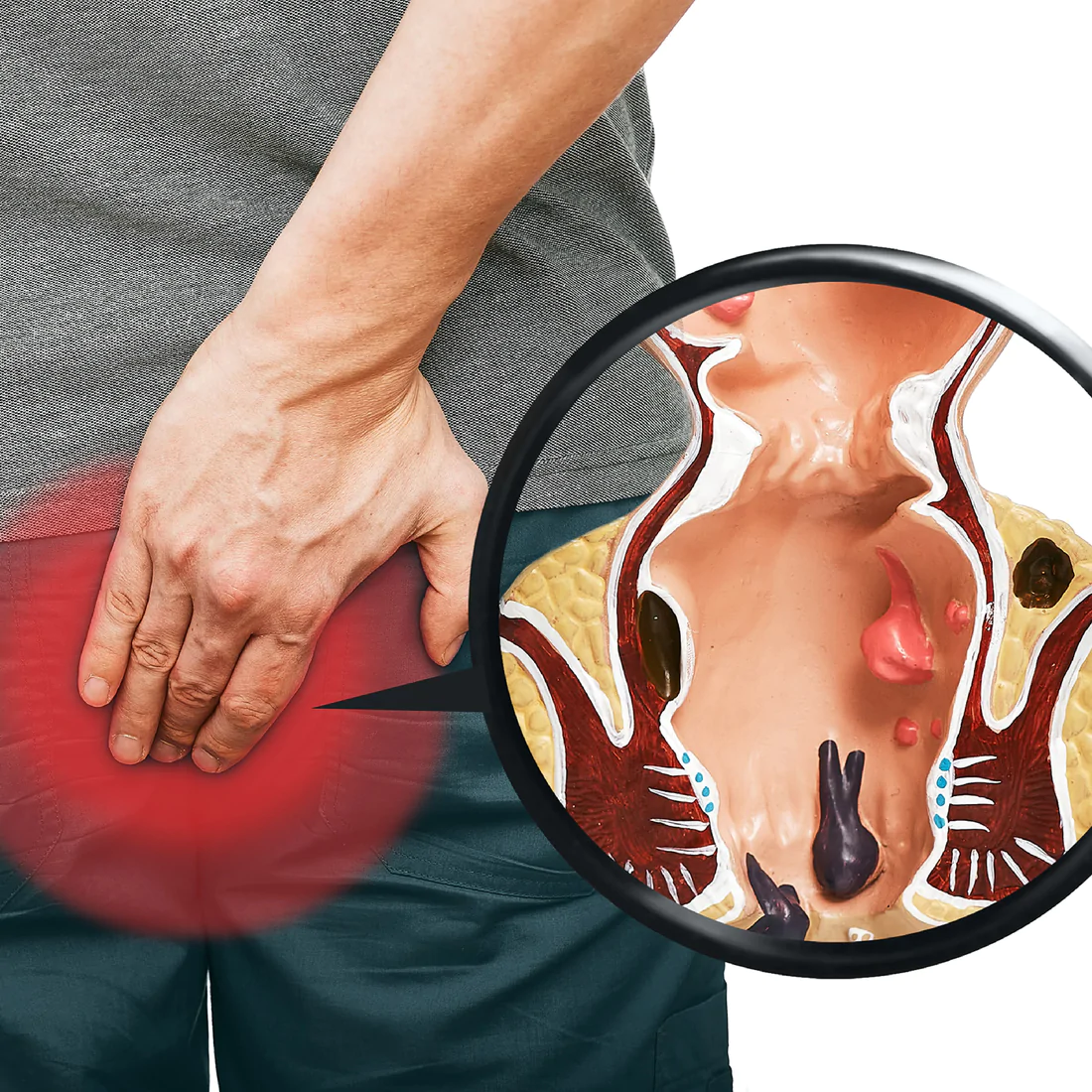 Herbal Hemorrhoids Calm Cream - Image 2