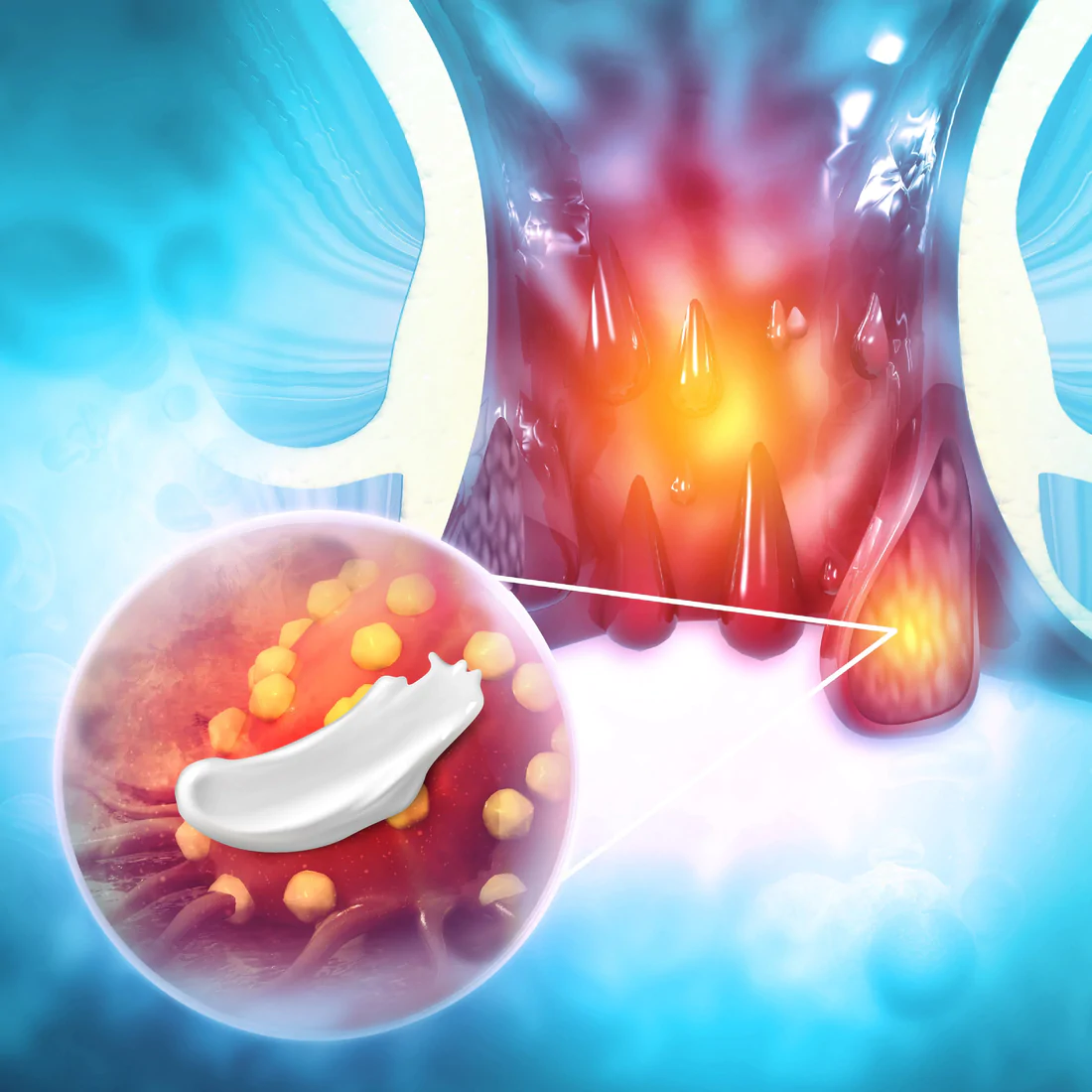 Herbal Hemorrhoids Calm Cream - Image 5