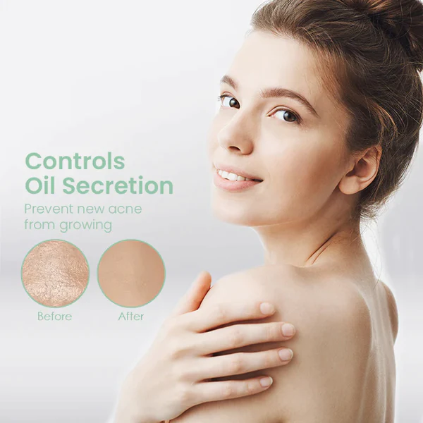 CLEARBAC™ Back Acne Treatment Spray - Image 4