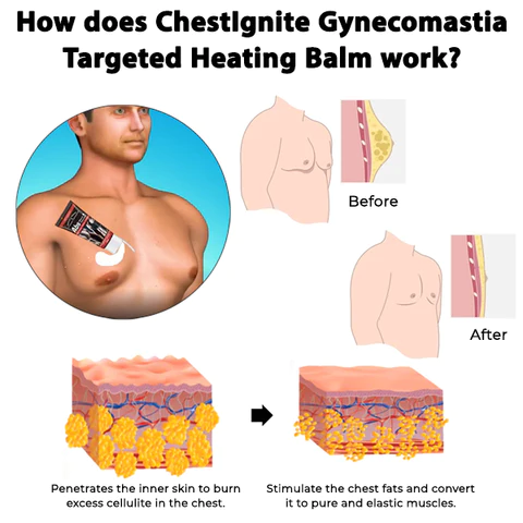 ChestIgnitePLUS Gynecomastia Targeted Heating Balm - Image 5
