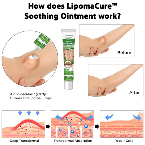 LipomaCure SCI Soothing Ointment - Image 5