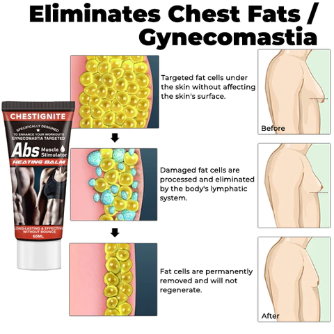 ChestIgnitePLUS Gynecomastia Targeted Heating Balm - Image 6