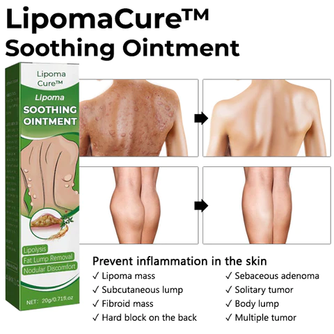 LipomaCure SCI Soothing Ointment - Image 7