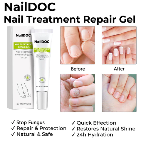 NARC™ Removal Paronychia Gel - Image 4