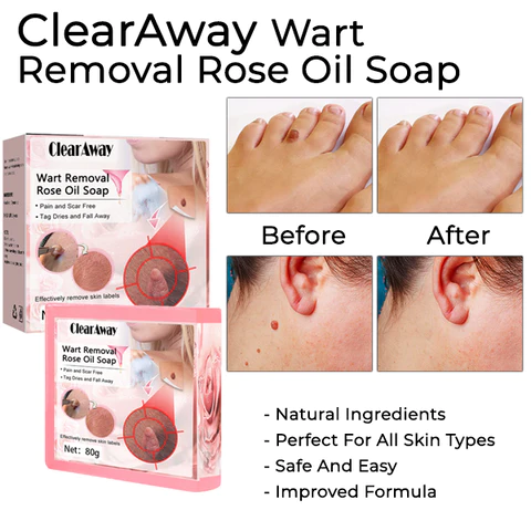 ClearAway PRO Wart Removal Rose Oil Soap - Image 7