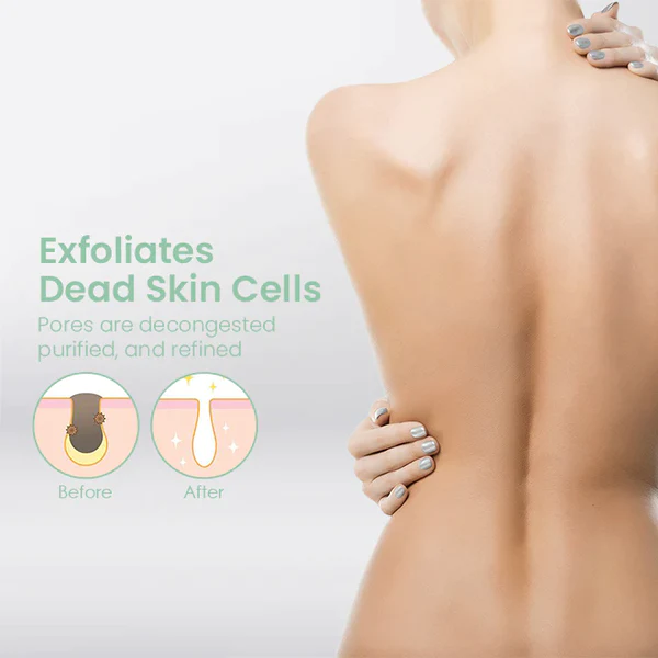 CLEARBAC™ Back Acne Treatment Spray - Image 3