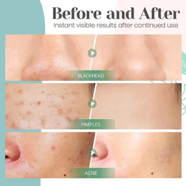 Green Tea Mask Bar - Image 4