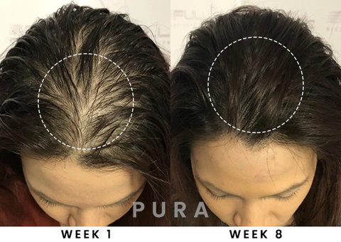 PURA Hair Reborn Biotin Shampoo - Image 7