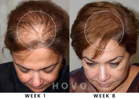 HOVO Hair Density Essential Oil - Image 7