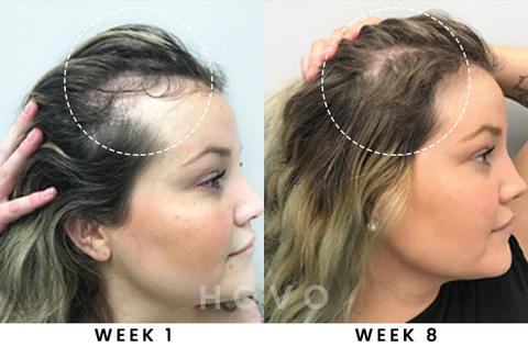 HOVO Hair Density Essential Oil - Image 6