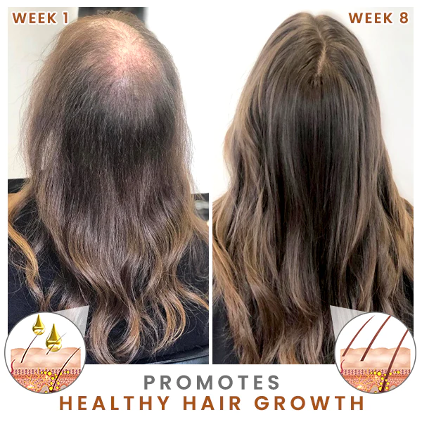 HOVO Hair Density Essential Oil - Image 4