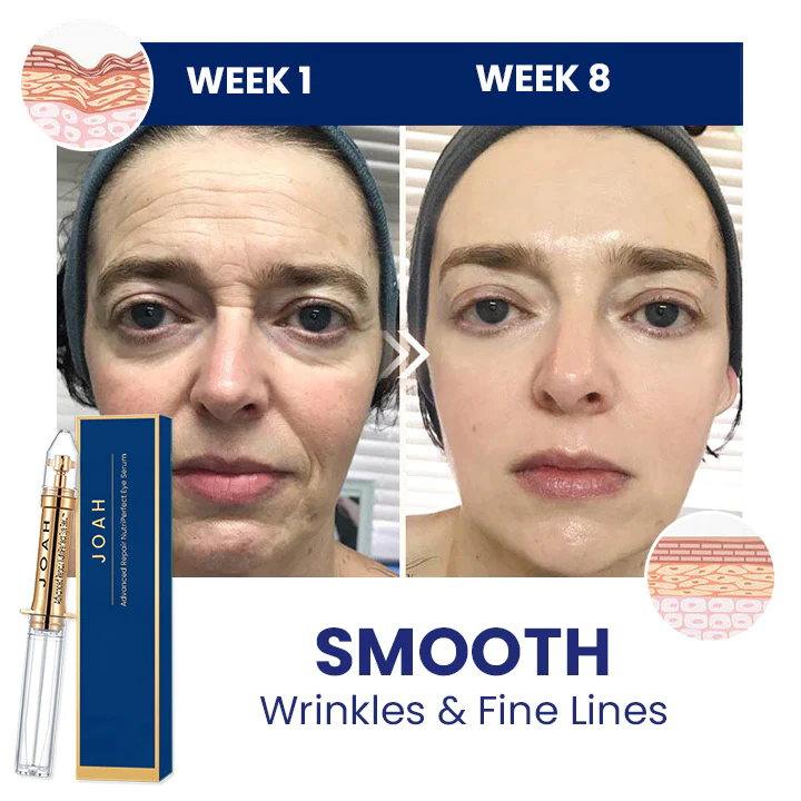 JOAH Advanced Repair NutriPerfect Eye Serum - Image 9