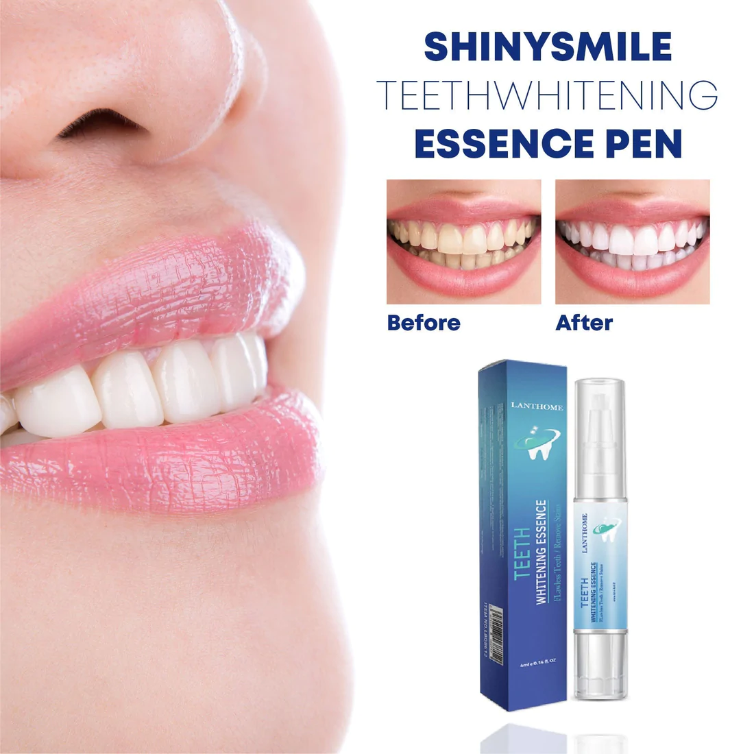 BrightSmile TeethWhitening Essence Pen - Image 2