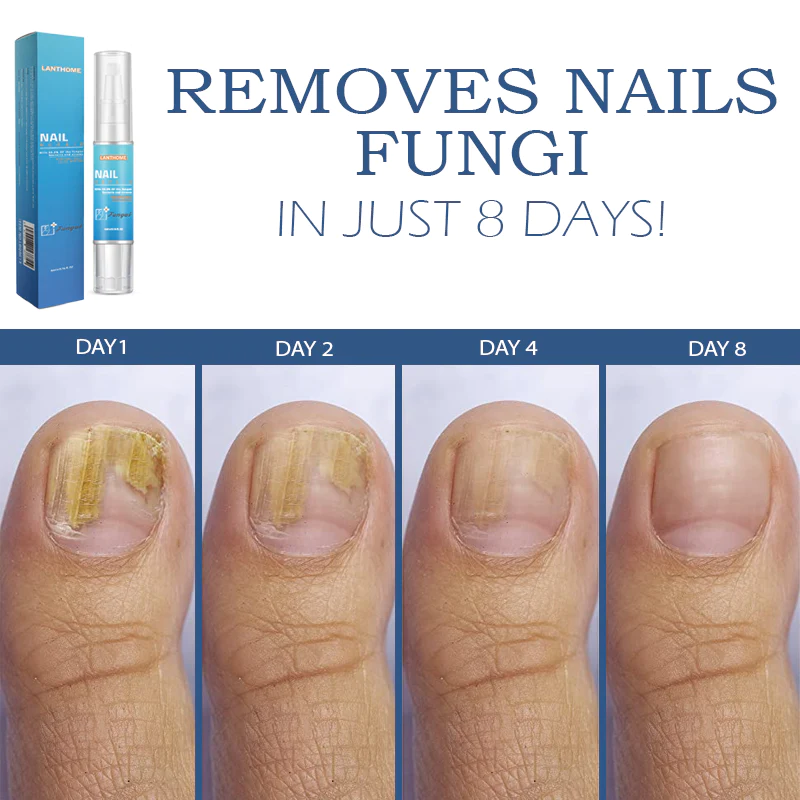 NailRenewal FungusTreatment Pen - Image 5