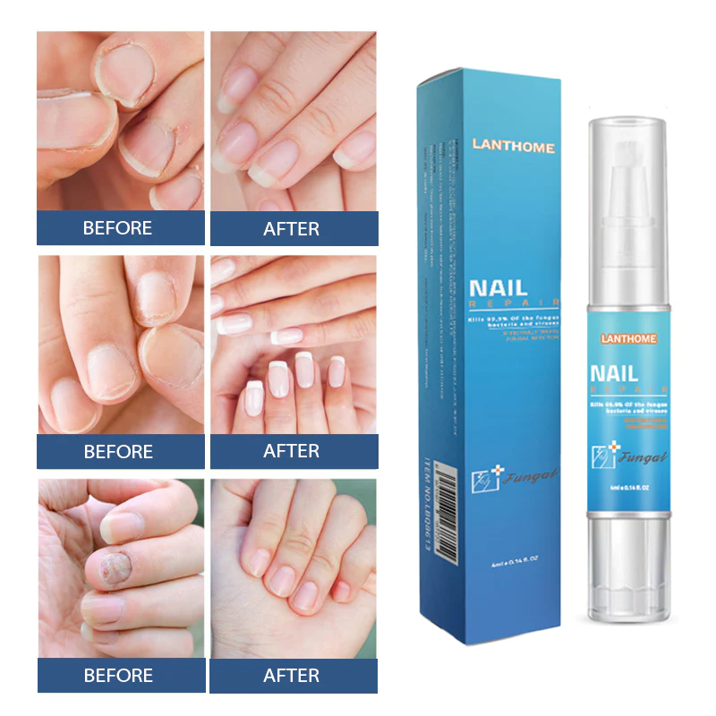 NailRenewal FungusTreatment Pen - Image 8