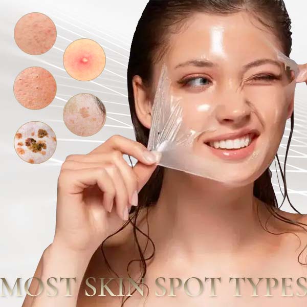 Oilex™ Natural Spots Whitening Yellow Peeling Oil - Image 2