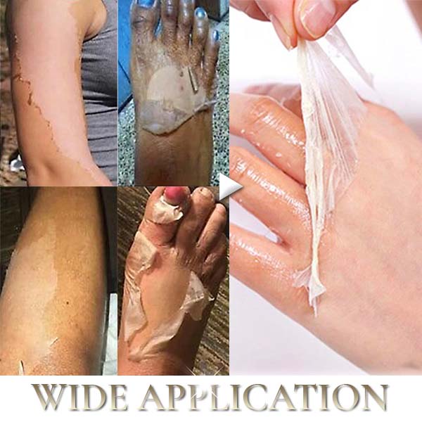 Oilex™ Natural Spots Whitening Yellow Peeling Oil - Image 4