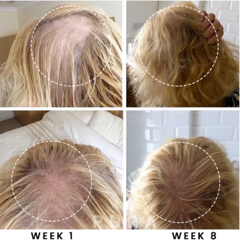 PURA Hair Reborn Biotin Shampoo - Image 6