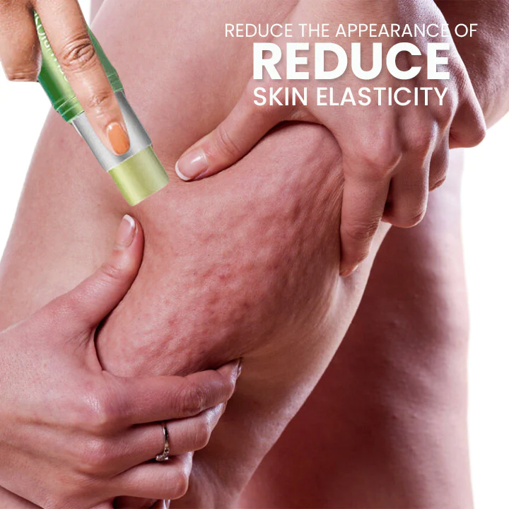 SusoSkin 2 In 1 Herbal Cellulite Soothing Balm - Image 2