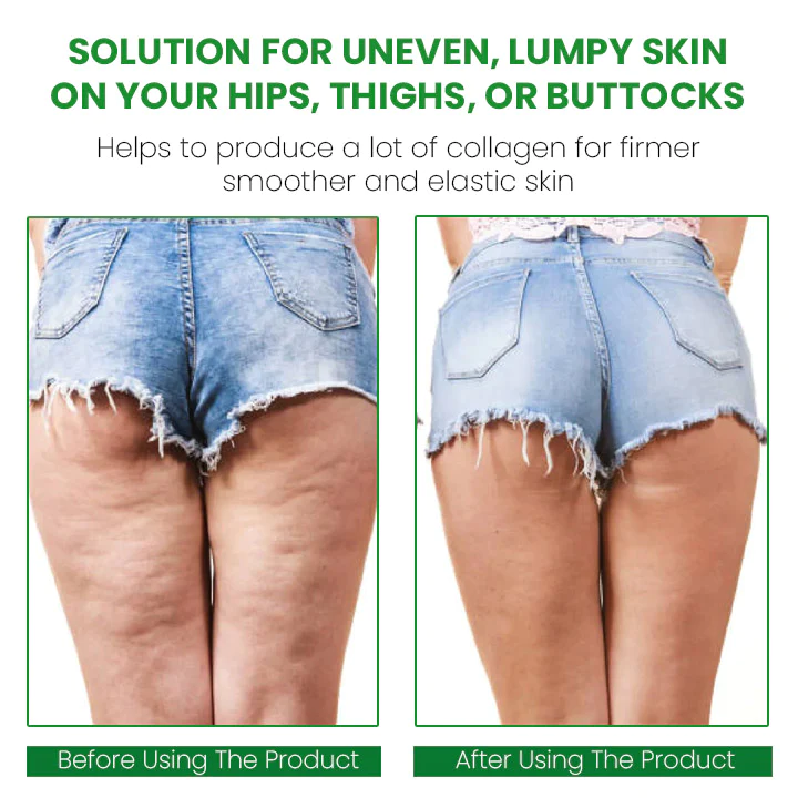 SusoSkin 2 In 1 Herbal Cellulite Soothing Balm - Image 8