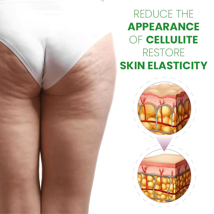 SusoSkin 2 In 1 Herbal Cellulite Soothing Balm - Image 9