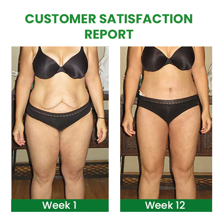 SusoSkin 2 In 1 Herbal Cellulite Soothing Balm - Image 4