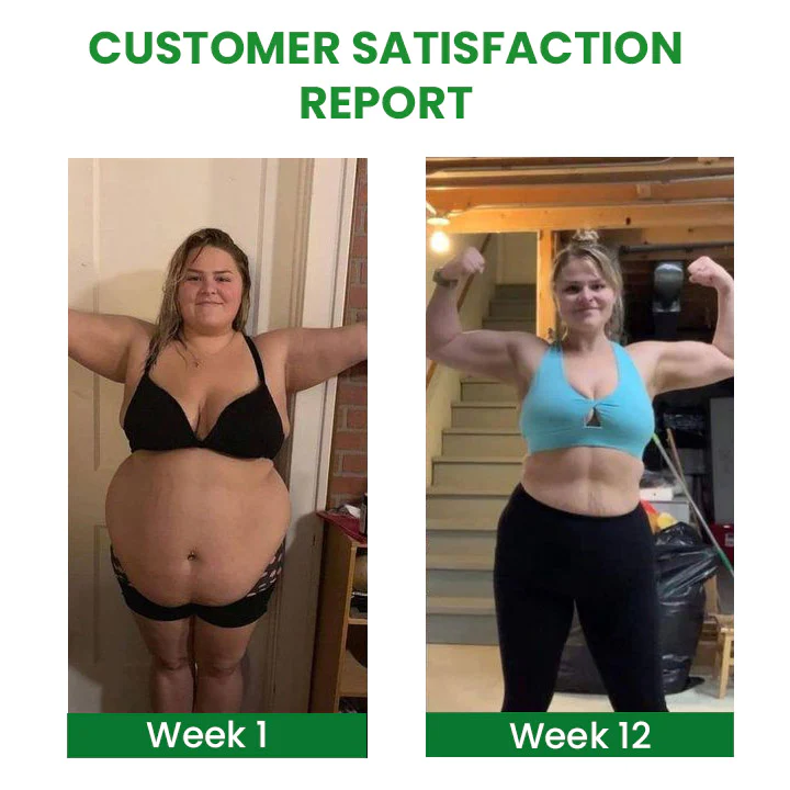 SusoSkin 2 In 1 Herbal Cellulite Soothing Balm - Image 5