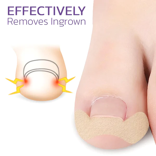 Japanese Elastic Toenail Correction Patch - Image 3