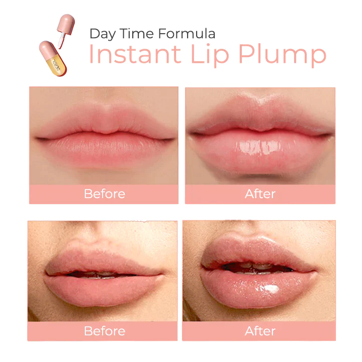 DEROL™ Lip Plumper Kit - Image 6