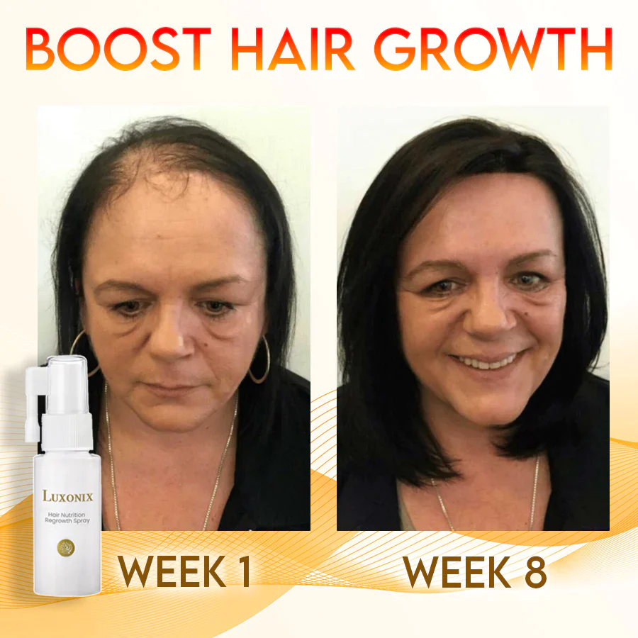Luxonix Hair Nutrition Regrowth Spray - Image 2