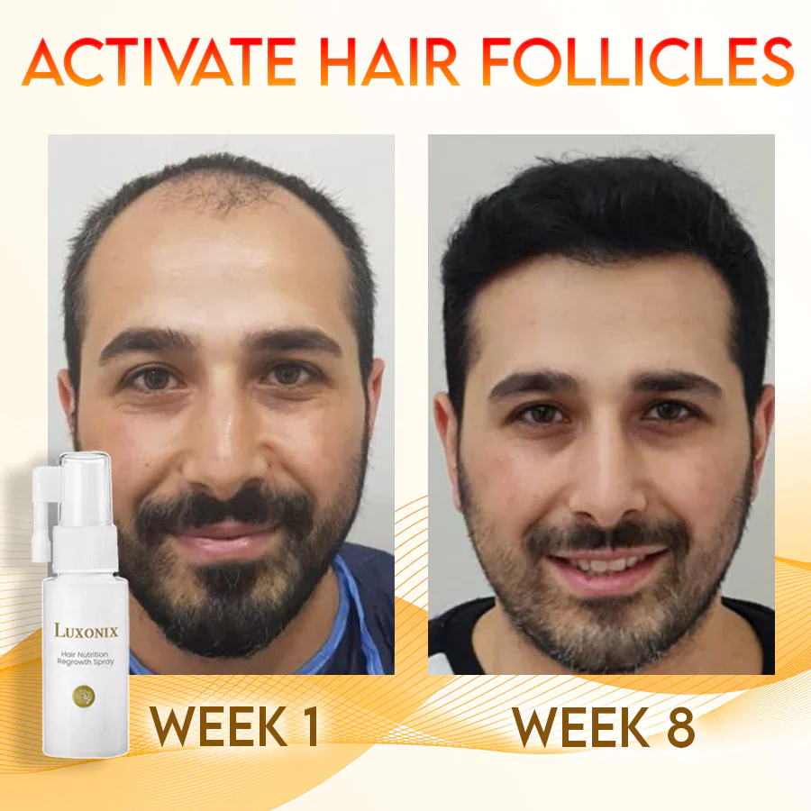 Luxonix Hair Nutrition Regrowth Spray - Image 4