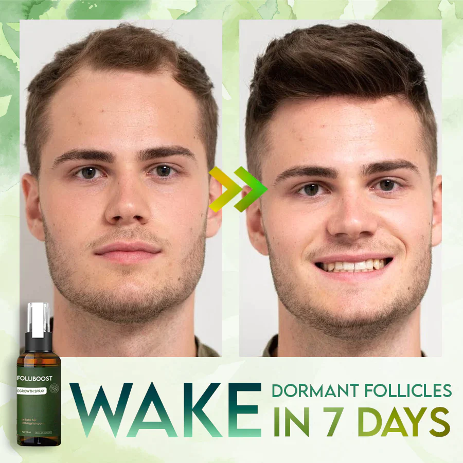 FolliBoost Hair Regrowth Spray - Image 3