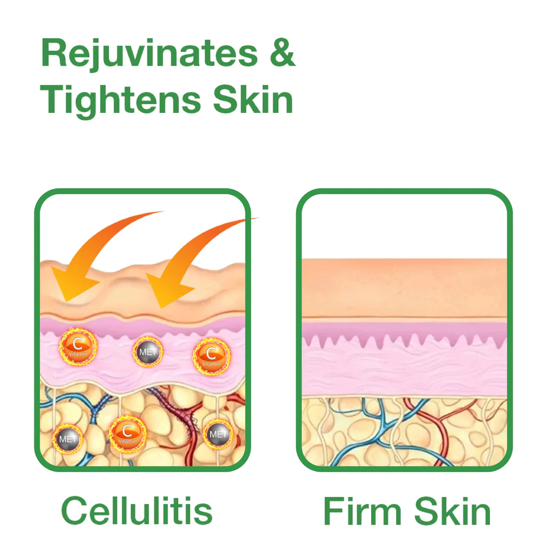 OriHerbs 2 In 1 Herbal Cellulite Reduction Balm - Image 3