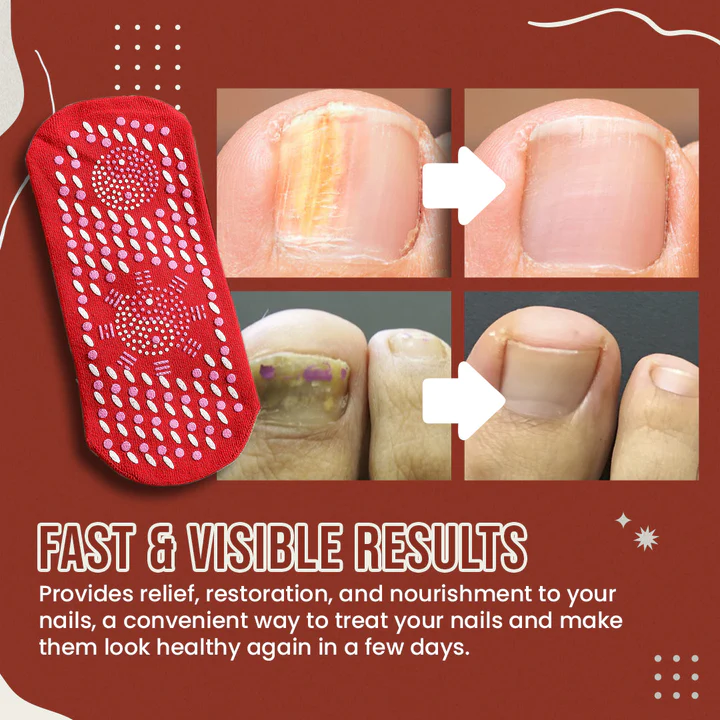 Nail Anti-Fungus Socks - Image 7