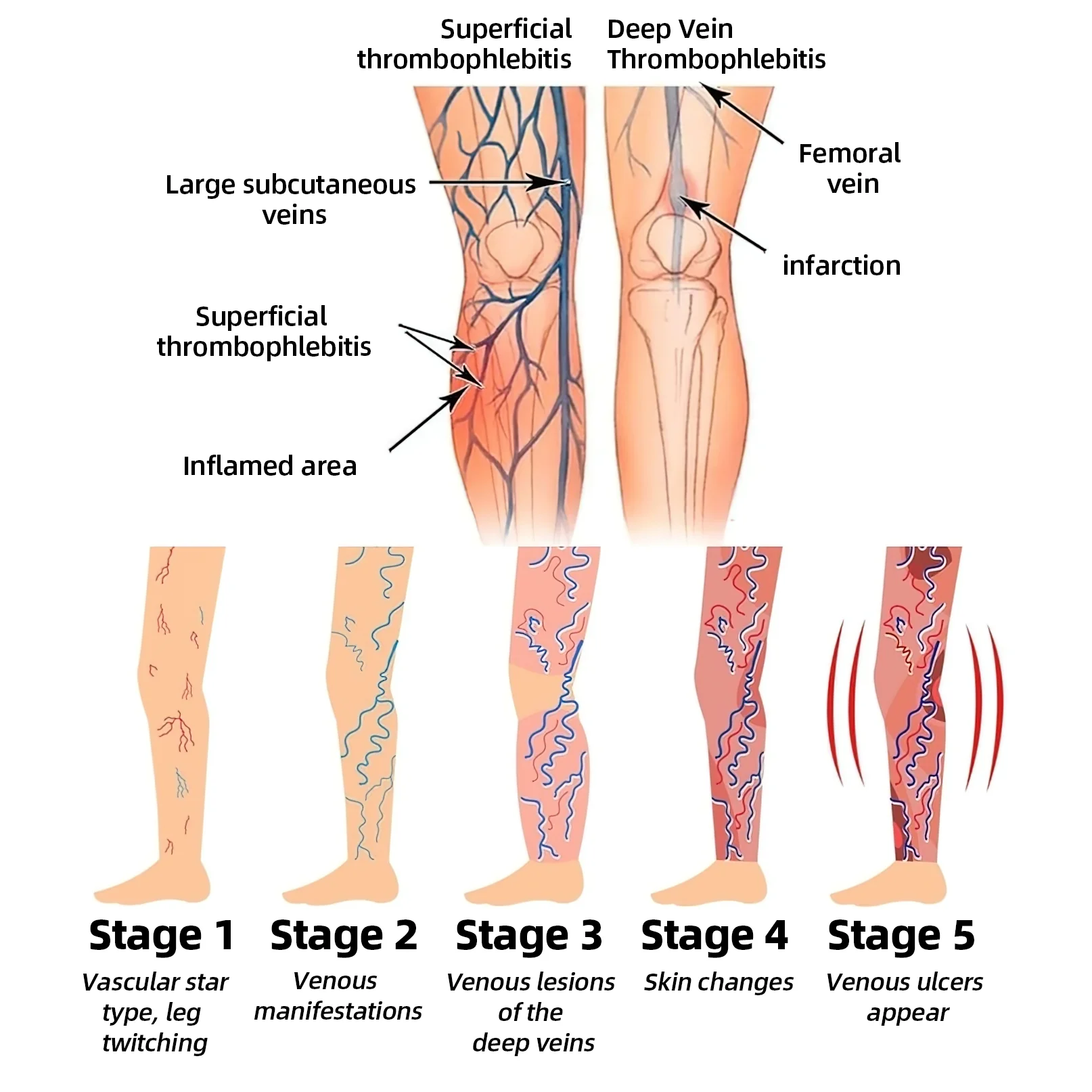 Мъниста за баня с пчелна отрова за отслабване и детоксикация VascuTone™ - Изображение 4