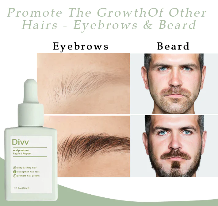 Divv™ Scalp Serum - Repair + Regrow Hair And Scalp - Image 5