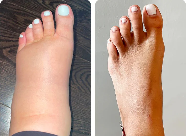 Мъниста за баня с пчелна отрова за отслабване и детоксикация VascuTone™ - Изображение 3