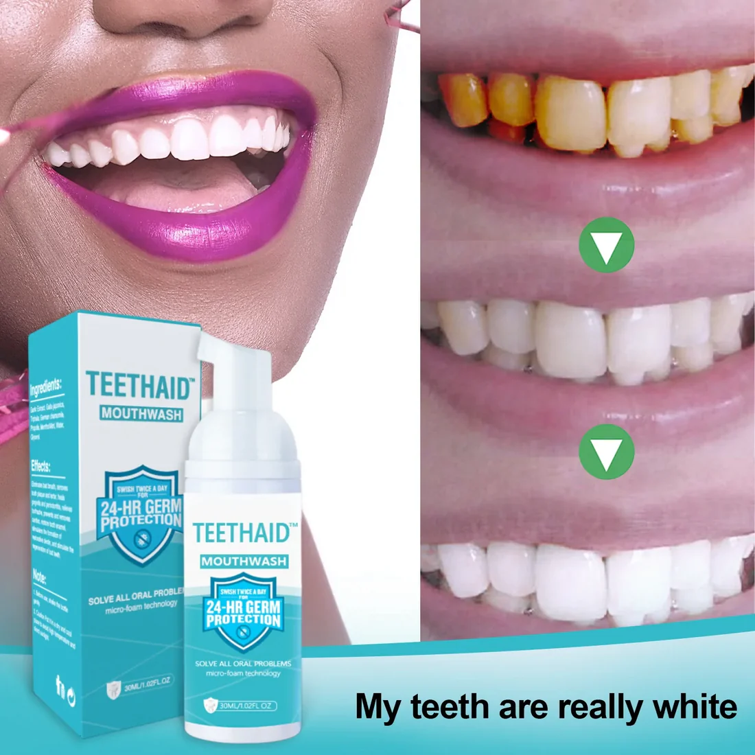 Teethaid™ Pure Herbal Super Whitening & Teeth & Mouth Repair Mousse - Image 3