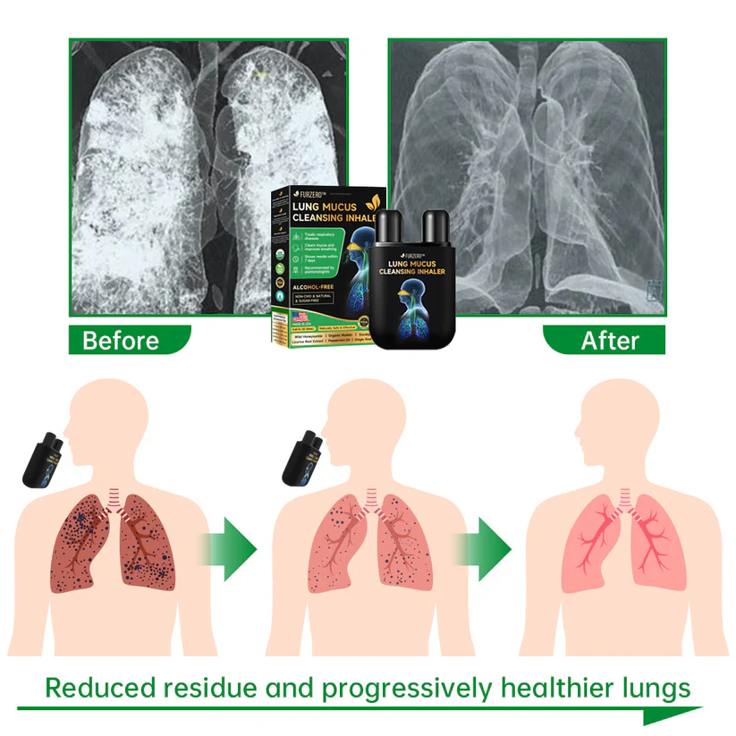 Furzero™ Lung Mucus Cleansing Inhaler - Image 6