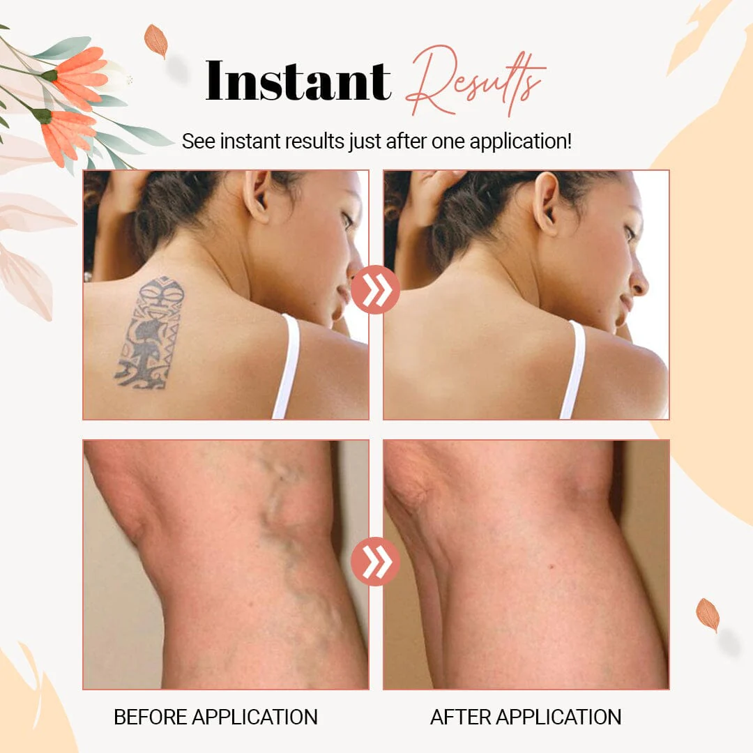 Body Foundation For Scars