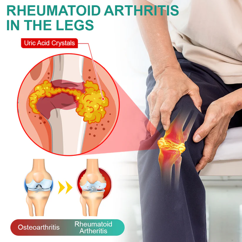 flysmus™ OsteoSerpent Joint Therapy Mist - Image 4