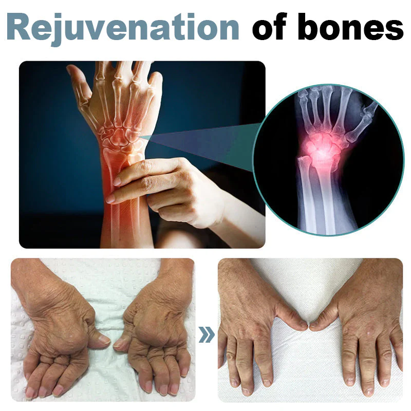 Dobshow™ Bee Venom Joint & Bone Repair Advanced Moisturizing Cream - Image 5