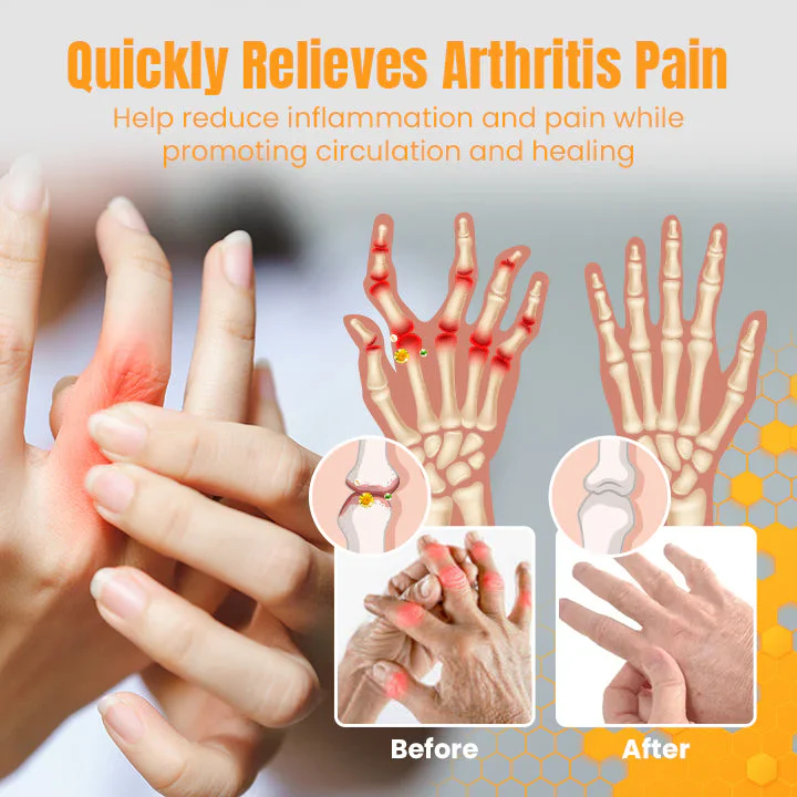 Fivfivgo™ TheraVen Bee Venom Joint Relief Gel - Image 4