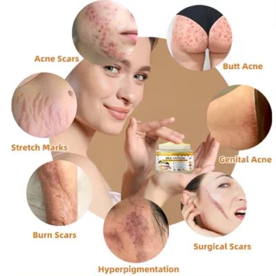 Lotmayโข Bee Venom Scar Removal and Intimate Area Acne Removal Cream