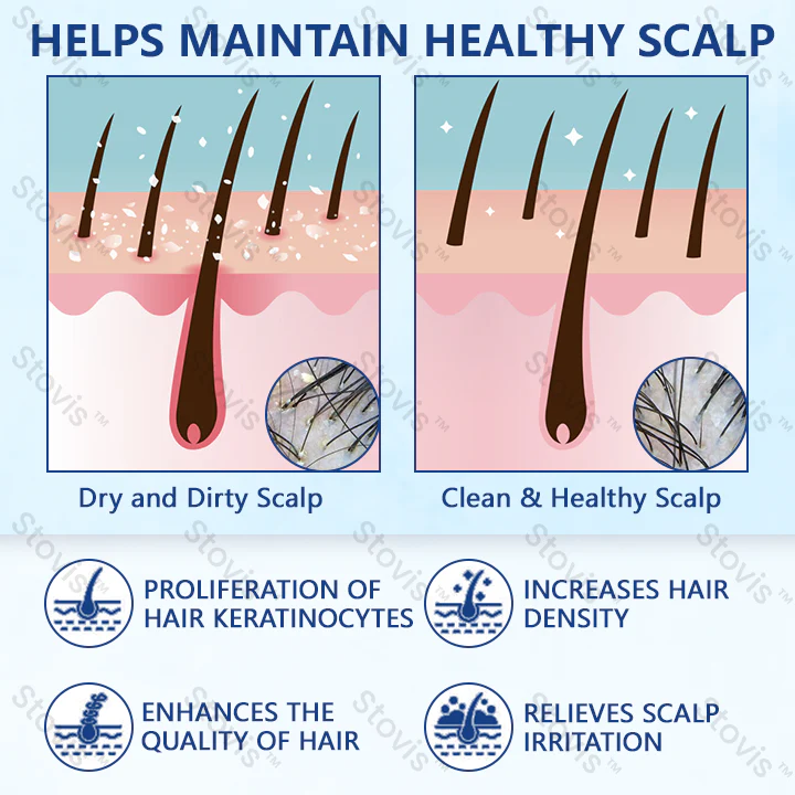 STOVIS™ RevitaRoot Hair Regrowth Cream - Image 3