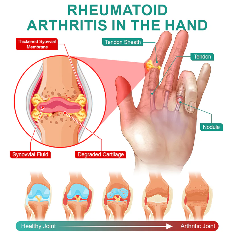 flysmus™ OsteoSerpent Joint Therapy Mist - Image 5