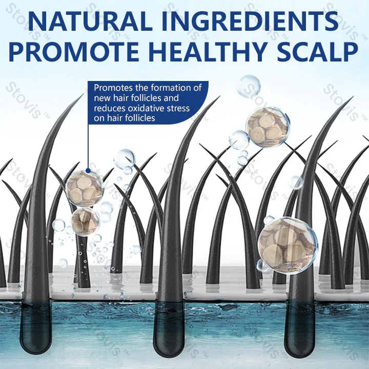 STOVIS™ RevitaRoot Hair Regrowth Cream - Image 4